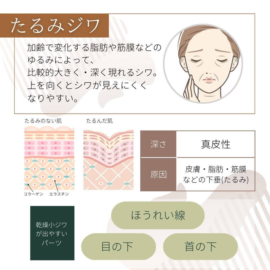 たるみジワの原因と特徴