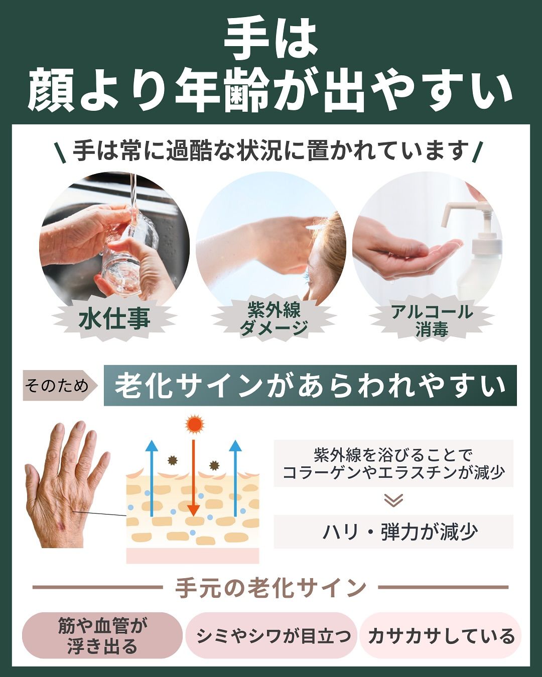 手は顔より年齢が出やすい