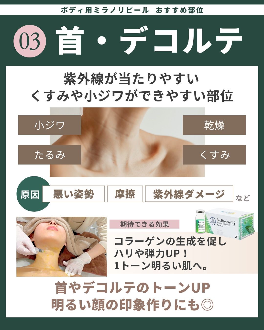 おすすめ部位「首・デコルテ」