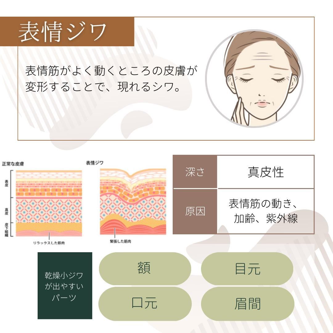 表情ジワの原因と特徴