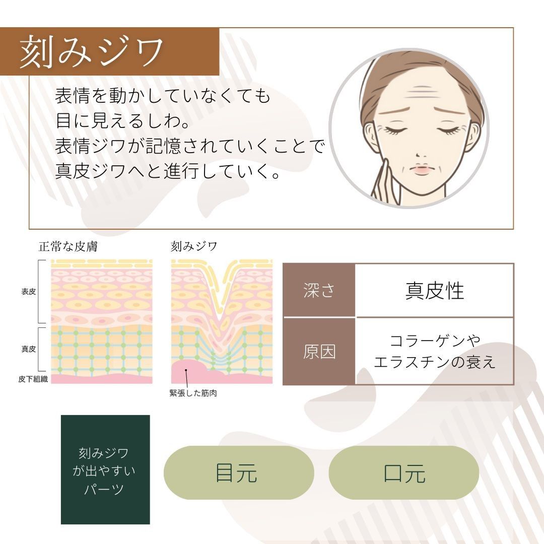 刻みジワの原因と特徴