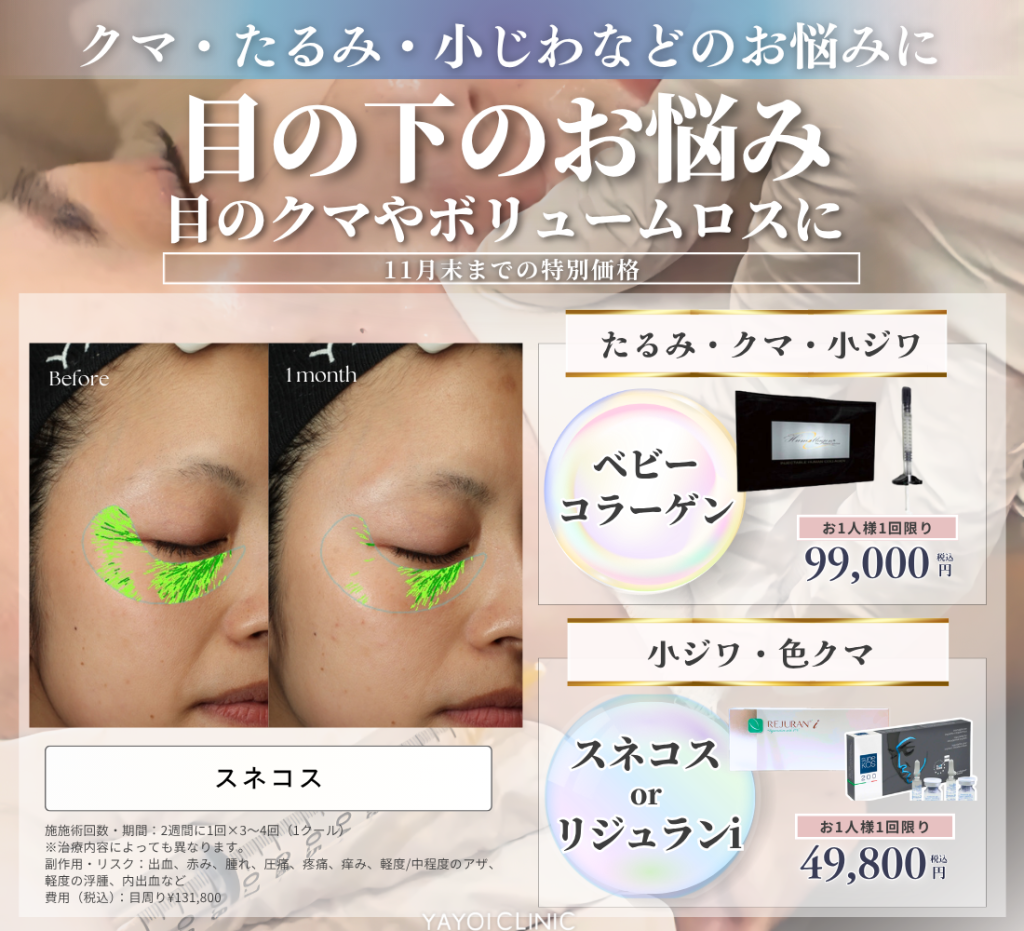 11月末までのご案内｜目の下のお悩みケア