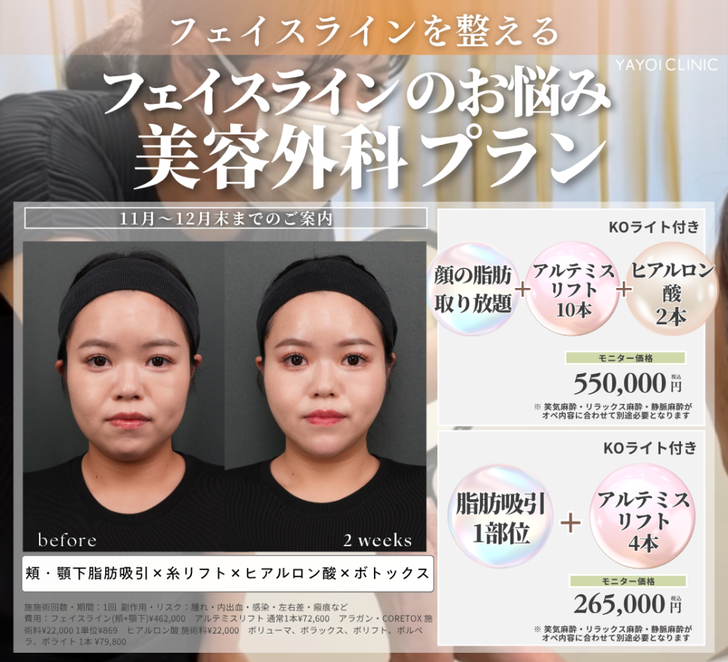 11月〜12月末までのご案内｜フェイスラインのお悩みに　【美容外科プラン】