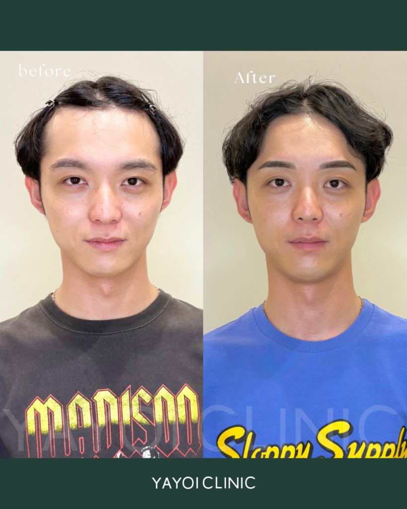 アートメイク